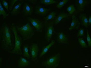 Phospho-Mcl1 (Ser159 + Thr163) Rabbit Polyclonal Antibody