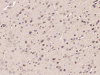 MDH1 Rabbit Polyclonal Antibody