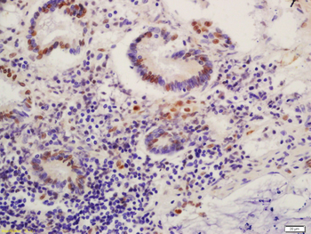 Phospho-MDM2 (Ser186) Rabbit Polyclonal Antibody