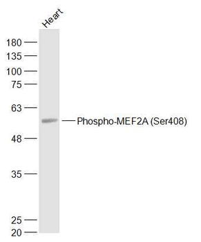 Phospho-MEF2A (Ser408) Rabbit Polyclonal Antibody