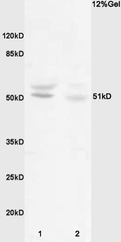 Phospho-MEF2C (Ser387) Rabbit Polyclonal Antibody