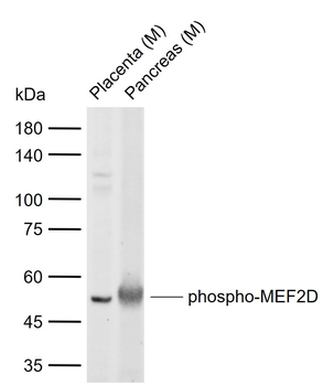 Phospho-MEF2D (Ser180) Rabbit Polyclonal Antibody