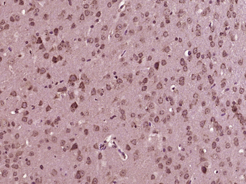 MLK3 Rabbit Polyclonal Antibody
