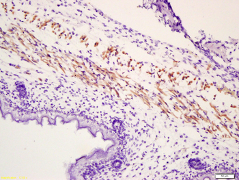 Phospho-MYL (Ser19) Rabbit Polyclonal Antibody