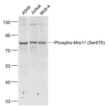 Phospho-Mre11 (Ser676) Rabbit Polyclonal Antibody