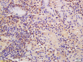 MTF-1 Rabbit Polyclonal Antibody