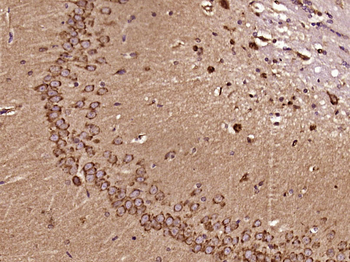 Phospho-RhoA (Ser188) Rabbit Polyclonal Antibody