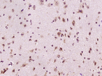 MVD Rabbit Polyclonal Antibody