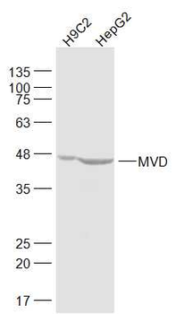 MVD Rabbit Polyclonal Antibody