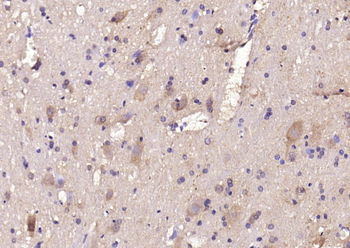 STXBP1/Munc18-1 Rabbit Polyclonal Antibody