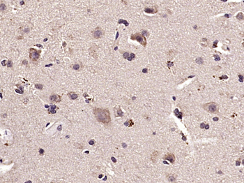 Phospho-NDRG1 (Thr346) Rabbit Polyclonal Antibody