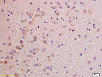 NDUFS1 Rabbit Polyclonal Antibody