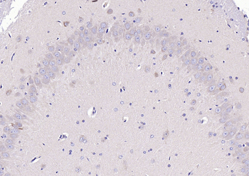 NDUFV2 Rabbit Polyclonal Antibody