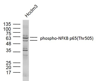 Phospho-NFKB p65 (Thr505) Rabbit Polyclonal Antibody