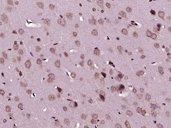Phospho-NFKB1 (Ser927) Rabbit Polyclonal Antibody