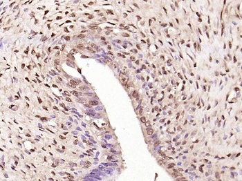 NFKB1 (phospho-Ser927) antibody