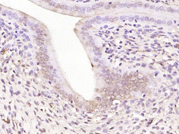 Phospho-NFKB1 (Thr931) Rabbit Polyclonal Antibody