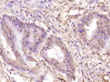 Phospho-NFKB1 (Ser907) Rabbit Polyclonal Antibody