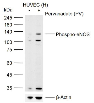 Phospho-eNOS (Ser1177) Rabbit Polyclonal Antibody