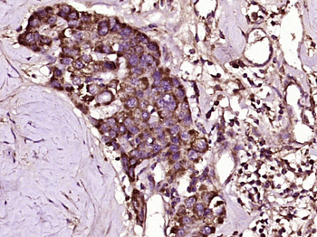 NPRC Rabbit Polyclonal Antibody