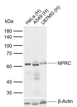 Natriuretic Peptide Receptor C antibody