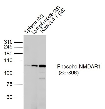 NMDAR1 (phospho-Ser896) antibody