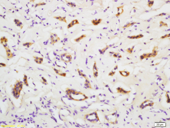 PMVK Rabbit Polyclonal Antibody