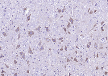 Phospho-NMDAR2A (Tyr1325) Rabbit Polyclonal Antibody