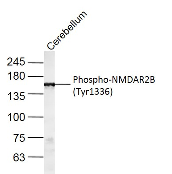 Phospho-NMDAR2B (Tyr1336) Rabbit Polyclonal Antibody