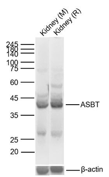SLC10A2 Rabbit Polyclonal Antibody