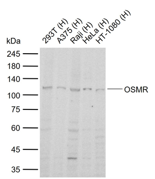 OSMR Rabbit Polyclonal Antibody