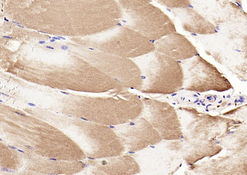 Phospho-CDKN1B (Thr157) Rabbit Polyclonal Antibody