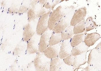 CDKN1B (phospho-Thr198) antibody