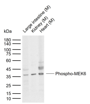 Phospho-MEK6 (Ser207) Rabbit Polyclonal Antibody