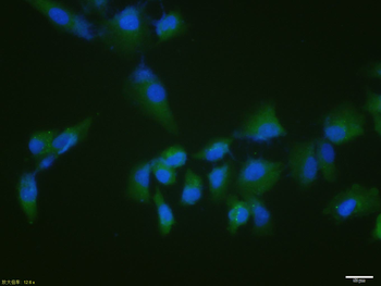 Phospho-P53 (Ser15) Rabbit Polyclonal Antibody