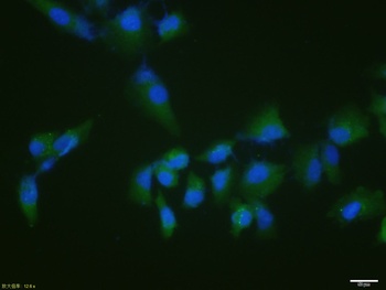 P53 (phospho-Ser15) antibody