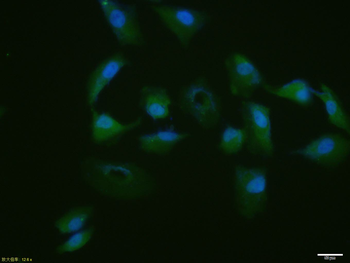 Phospho-P53 (Ser33) Rabbit Polyclonal Antibody