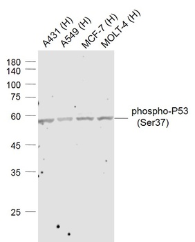 P53 (phospho-Ser37) antibody