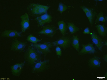 Phospho-P53 (Thr55) Rabbit Polyclonal Antibody