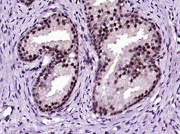 Phospho-p63 (Ser395) Rabbit Polyclonal Antibody