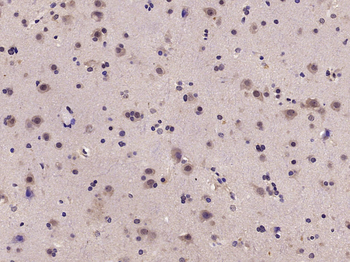 Phospho-RPS6KB1 (Ser417) Rabbit Polyclonal Antibody
