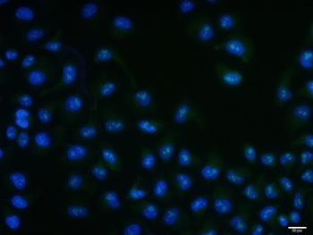 RPS6KB1 (phospho-Ser418) antibody