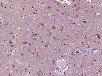 Phospho-RPS6KB1 (Ser434) Rabbit Polyclonal Antibody
