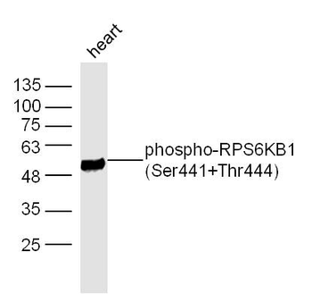 Phospho-RPS6KB1 (Ser441+Thr444) Rabbit Polyclonal Antibody