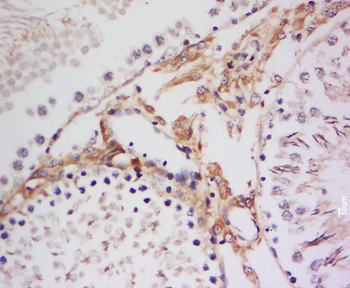 Phospho-RPS6KA1 (Thr359 + Ser363) Rabbit Polyclonal Antibody
