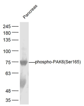 Phospho-PAK6 (Ser165) Rabbit Polyclonal Antibody