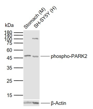 Phospho-PARK2 (Ser378) Rabbit Polyclonal Antibody