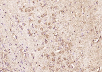 Parkin (phospho-Ser378) antibody