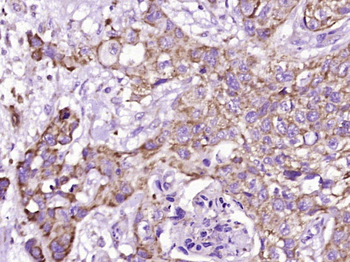 Thymidine phosphorylase Rabbit Polyclonal Antibody