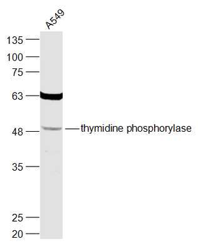 Thymidine phosphorylase Rabbit Polyclonal Antibody